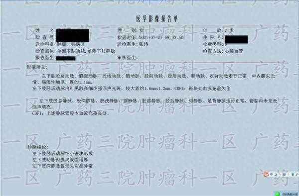 #乳腺癌术后需要化疗吗#广东药科大学广州复星禅诚医院肿瘤一区